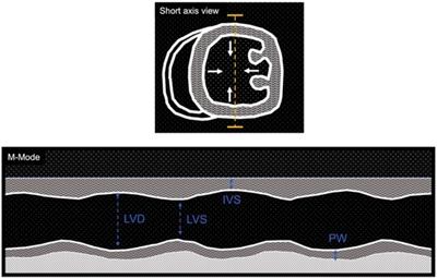 State-of-the-art methodologies used in preclinical studies to assess left ventricular diastolic and systolic function in mice, pitfalls and troubleshooting